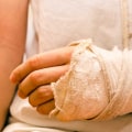 What are examples of personal injuries?